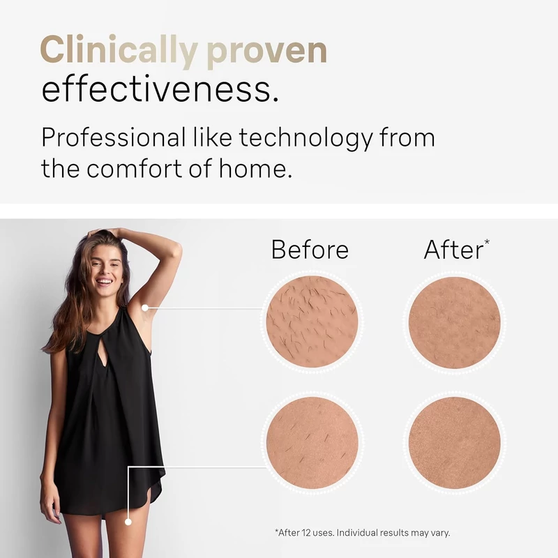 Braun PL5152 Silk-expert Pro 5 IPL villanófényes szőrtelenítő - Fehér/Arany