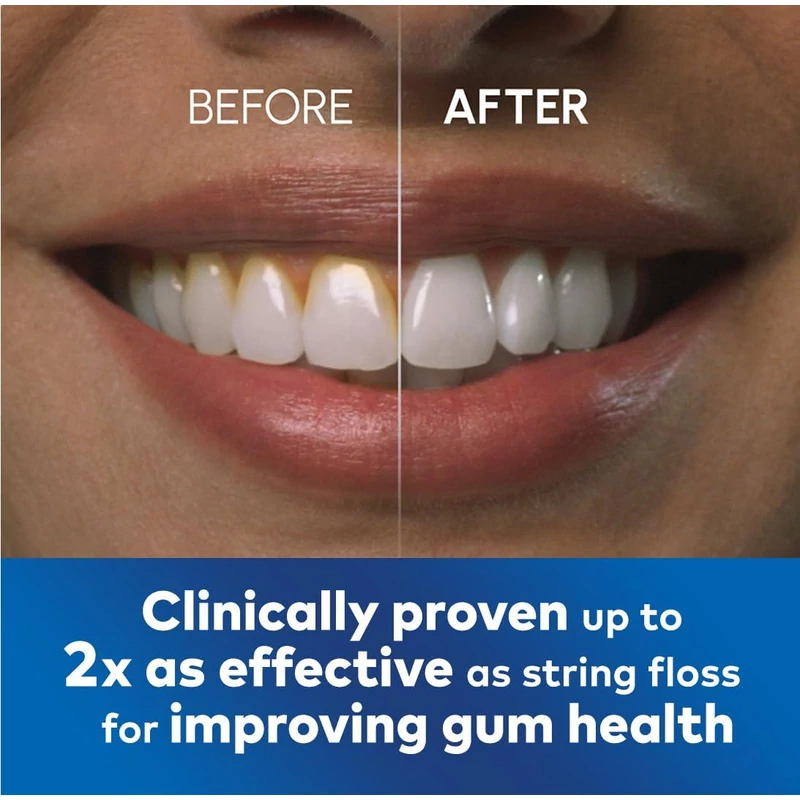 Waterpik Cordless Advanced szájzuhany - Kék (WP-583)