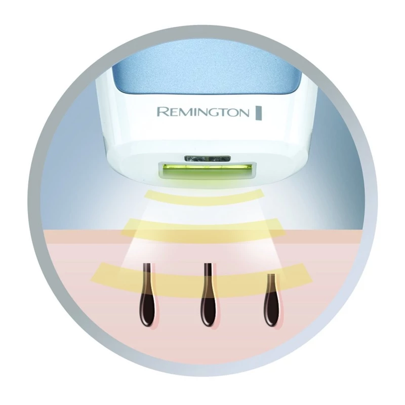 Remington IPL3500 Compact Control HPL tartós szőrtelenítő (IPL3500)